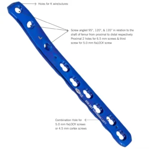 fixLock Proximal Femur Plates