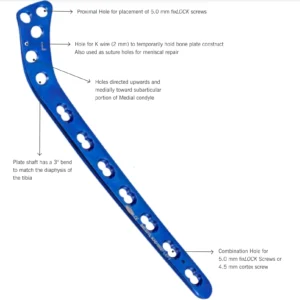 fixLock Proximal Tibia Plates